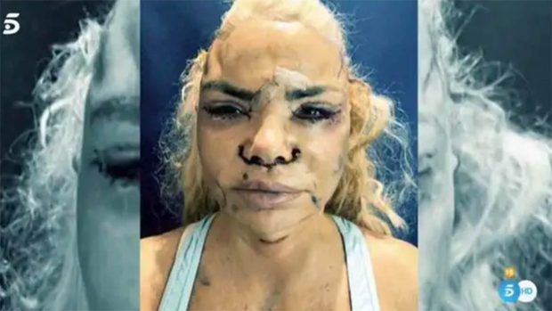 Leticia Sabater después de un retoque estético / Telecinco