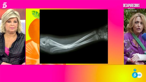 Lydia Lozano destrozada cuenta entre lágrimas cómo ha sido su caída / Telecinco