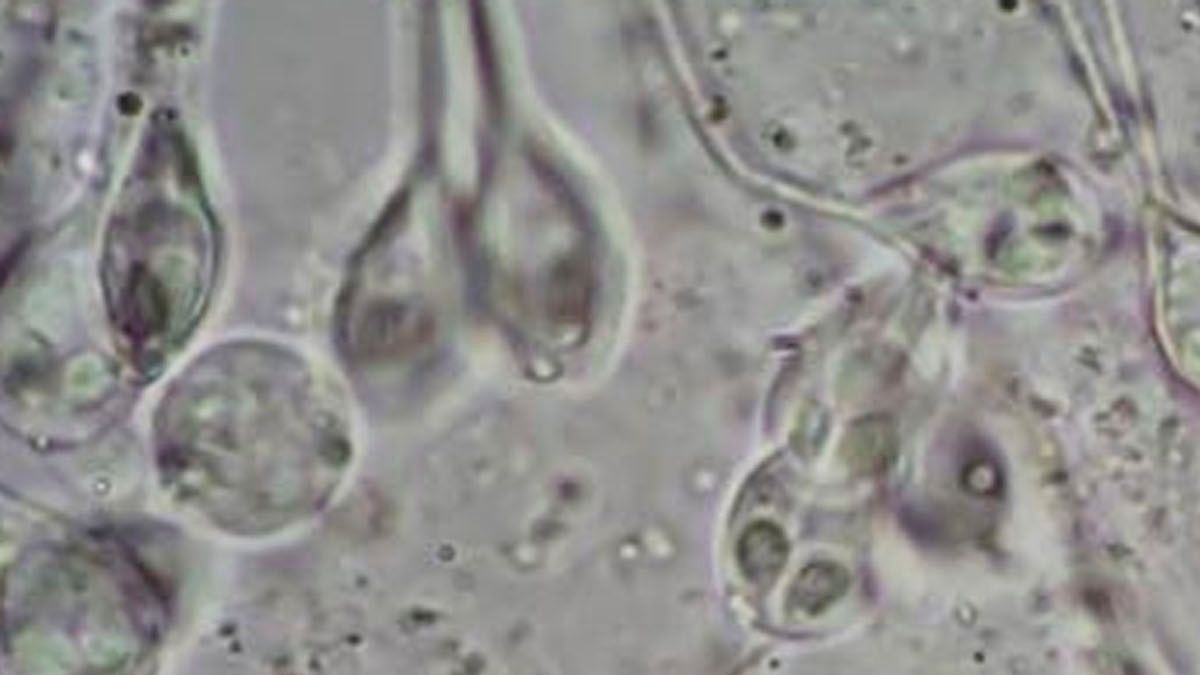 Descubren un animal que puede vivir sin oxígeno