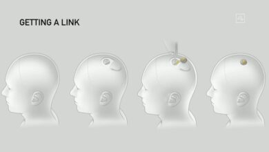 Elon Musk demuestra la tecnología de Neuralink en vivo usando cerdos con dispositivos de monitoreo cerebral implantados quirúrgicamente