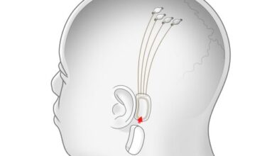 Elon Musk establece una actualización sobre la compañía de interfaz cerebro-computadora Neuralink para el 28 de agosto