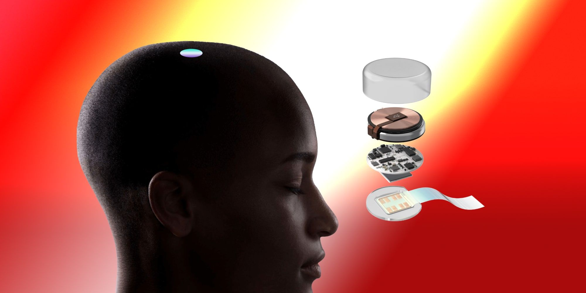 Elon Musk se duplica en la afirmación de que el chip cerebral puede tratar la obesidad mórbida