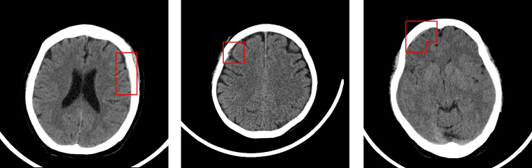 La startup taiwanesa Deep01 recauda $ 2.7 millones para su software de imágenes médicas basado en IA