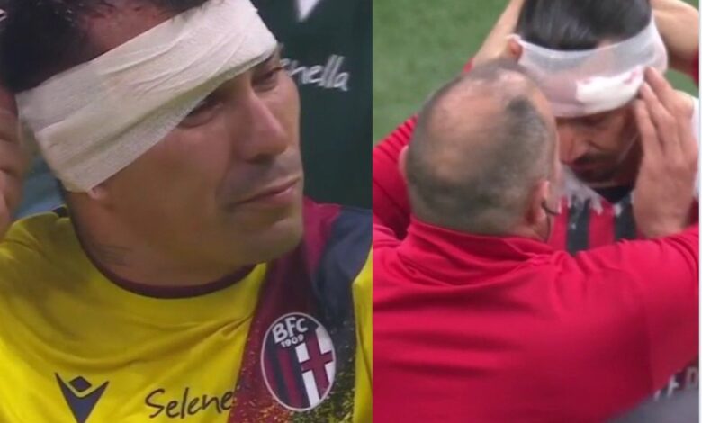 Terminan Zlatan Ibrahimovic y Gary Medel heridos, vendados y muy enojados | Video