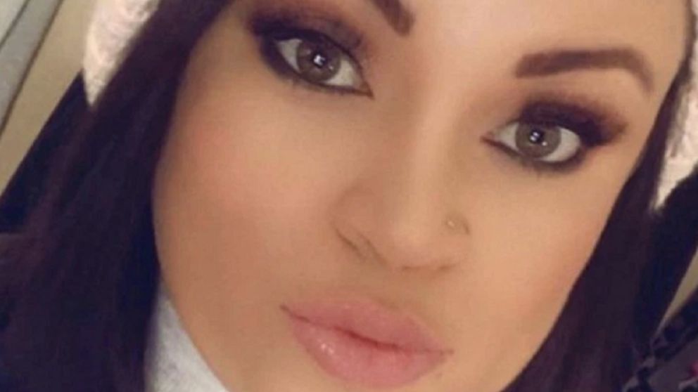 Una crema facial le destroza la cara a una joven inglesa