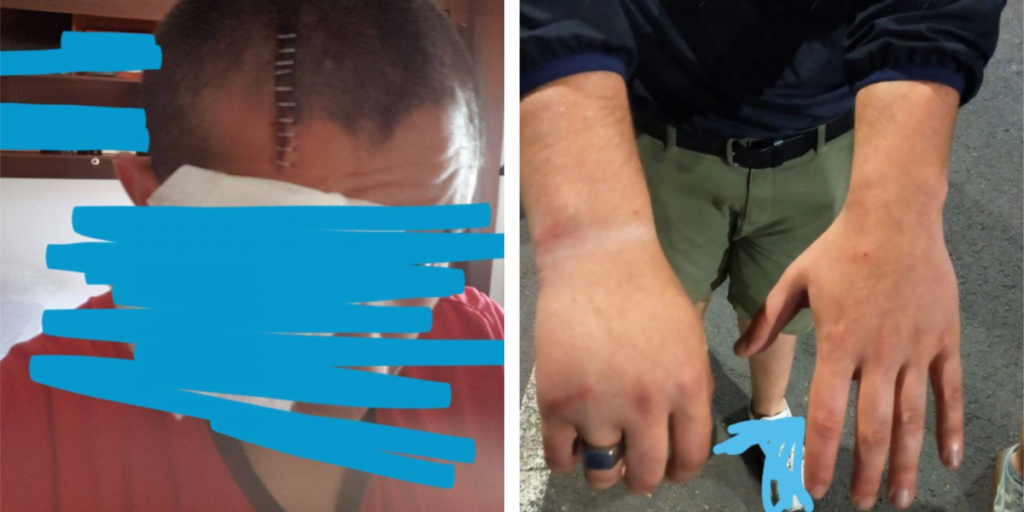 20 puntos de sutura en la cabeza, un codo y una muñeca rotos y decenas de porrazos