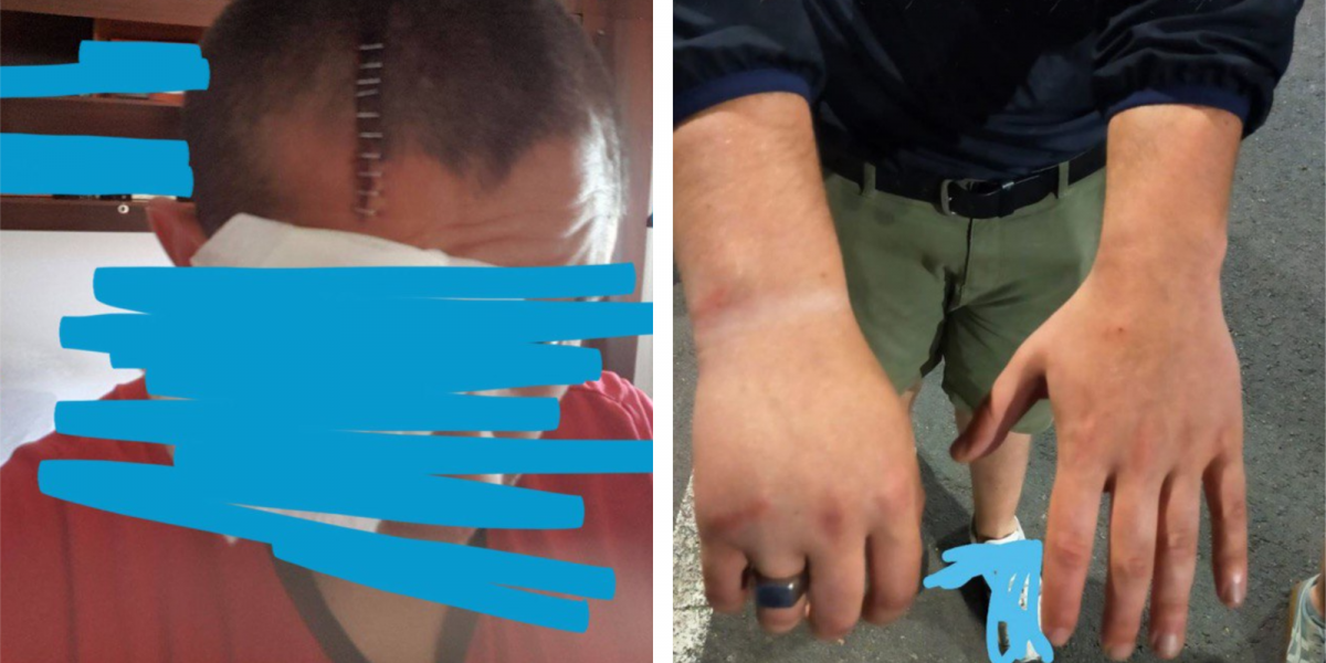 20 puntos de sutura en la cabeza, un codo y una muñeca rotos y decenas de porrazos