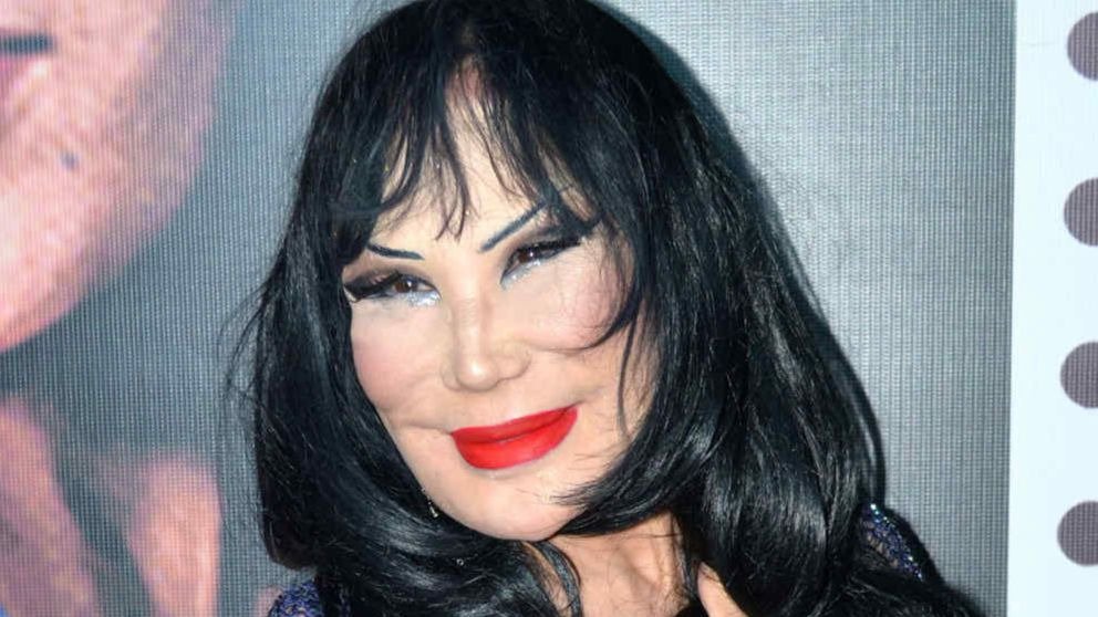 3 curiosidades de la medicina estética que te sorprenderán