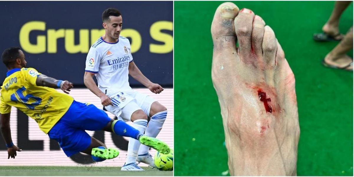 Akapo, unos dos meses de baja tras el entradón de Hazard