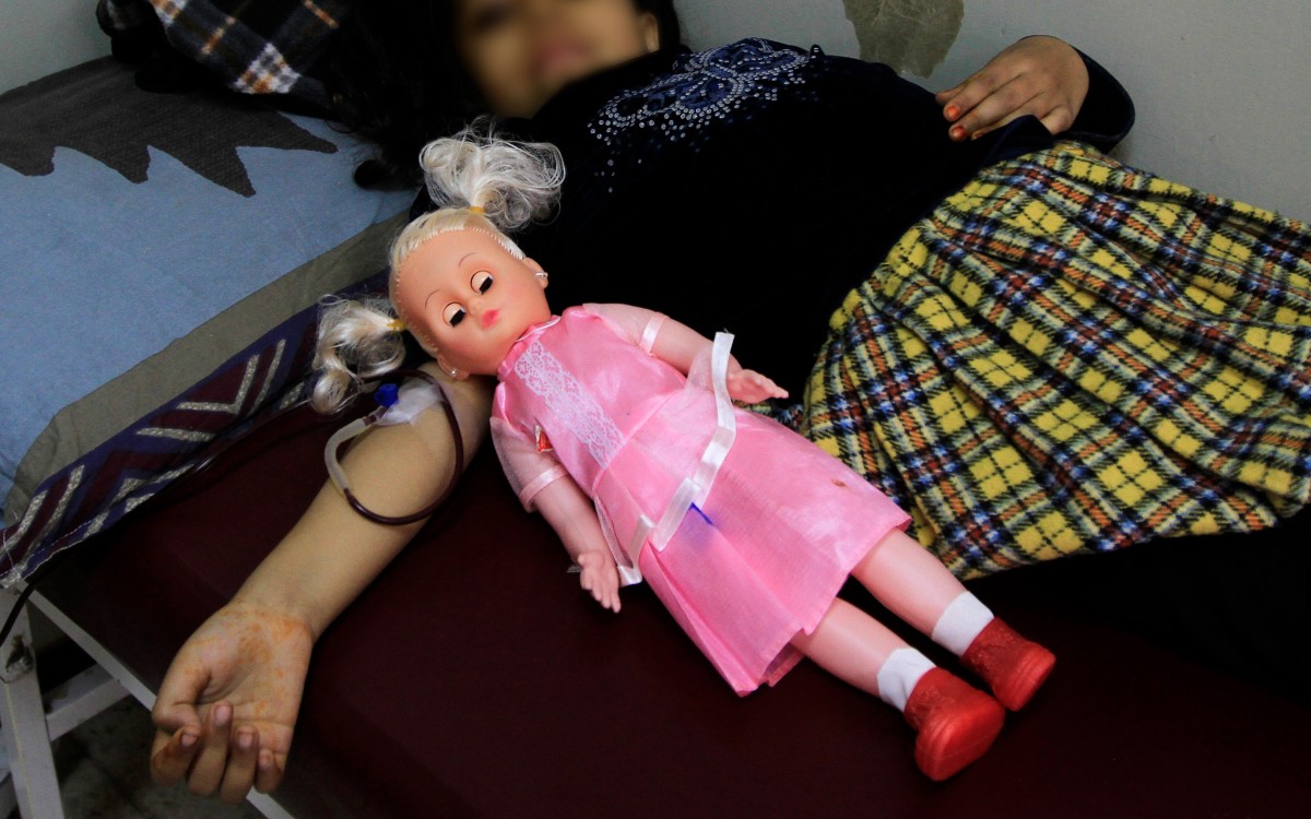 Aumenta hepatitis infantil grave en el mundo; México no reporta casos | Video