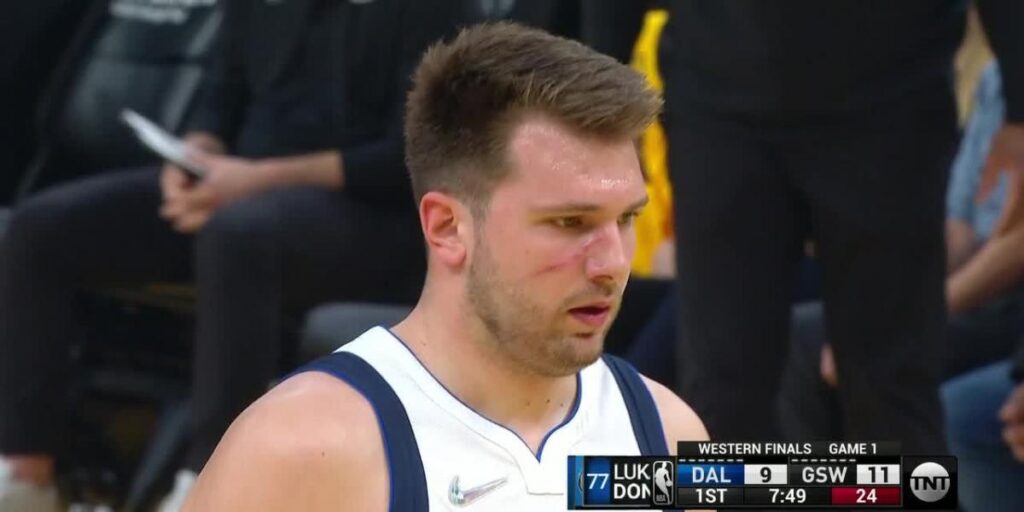 Doncic tras el arañazo de Wiggins en la cara: "Estoy bien, ahora parezco un tipo duro"