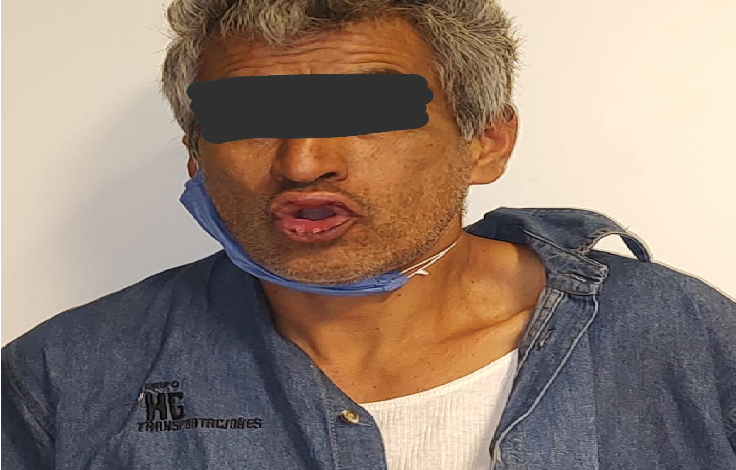 Golpeó a su pareja sentimental, en San Juan del Río, van en aumento agresiones contra mujeres