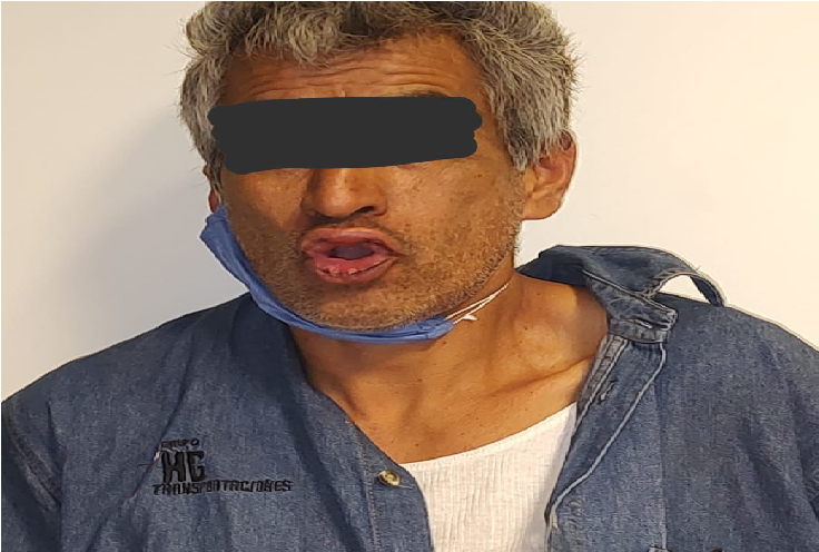 Golpeó a su pareja sentimental, en San Juan del Río, van en aumento agresiones contra mujeres