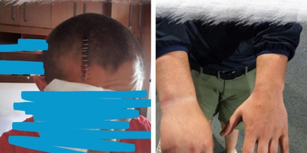 Guillermo Toledo denuncia la agresión a Bultzada