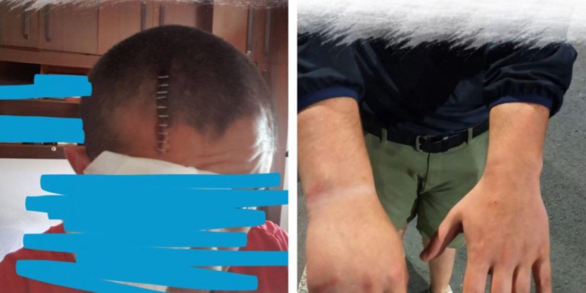 Guillermo Toledo denuncia la agresión a Bultzada