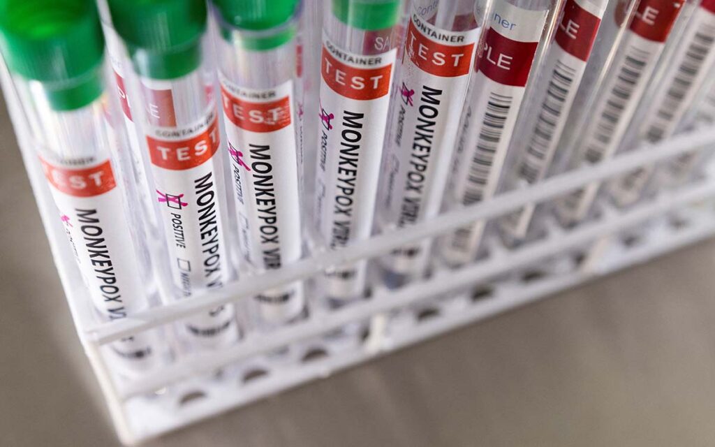 La OMS pide aumentar vigilancia por propagación de la viruela del mono