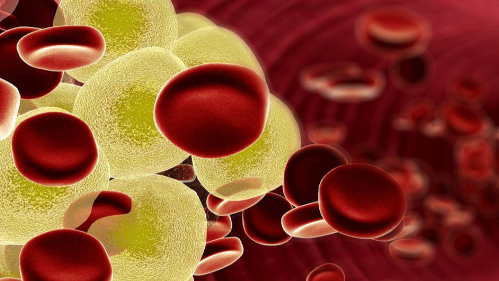 La vacuna contra el colesterol se probará en Reino Unido