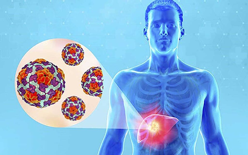 Nuevo brote mundial de hepatitis infantil no es de virus conocidos o frecuentes: especialista de la UNAM