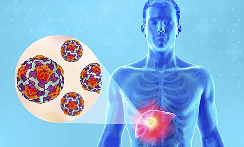 Nuevo brote mundial de hepatitis infantil no es de virus conocidos o frecuentes: especialista de la UNAM