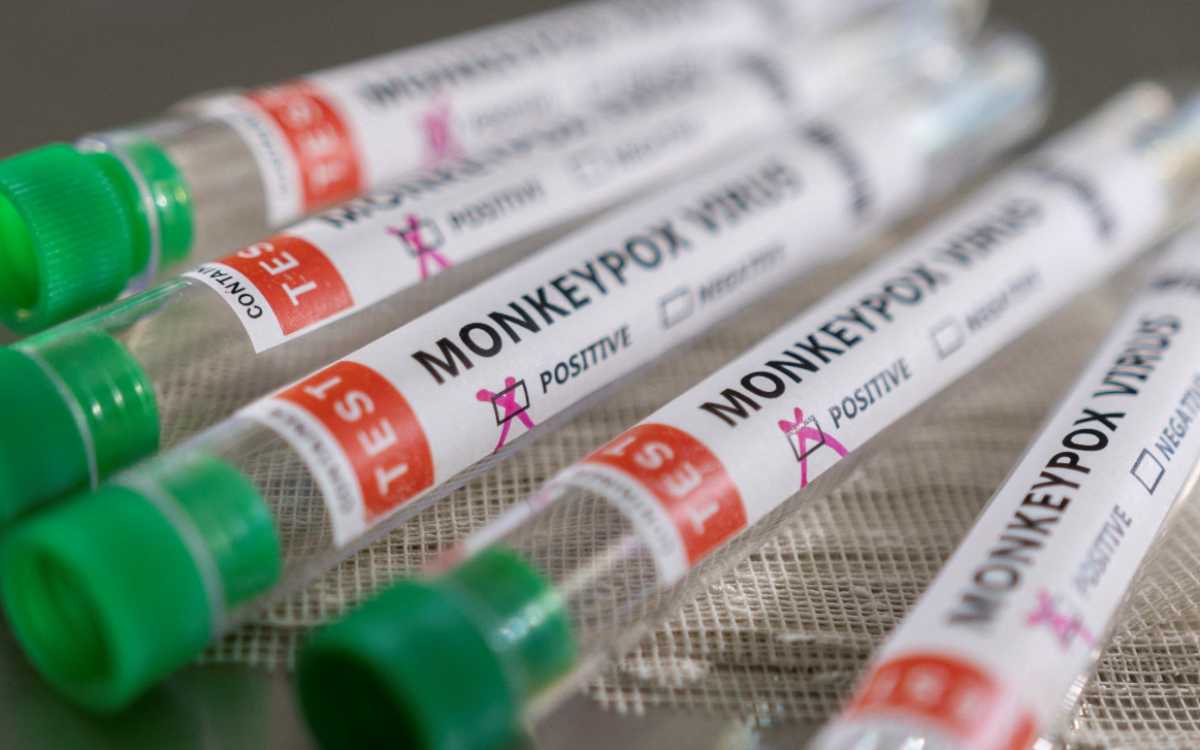 ONU condena “estigmatización LGBTI y de los africanos” en reportes sobre la viruela del mono