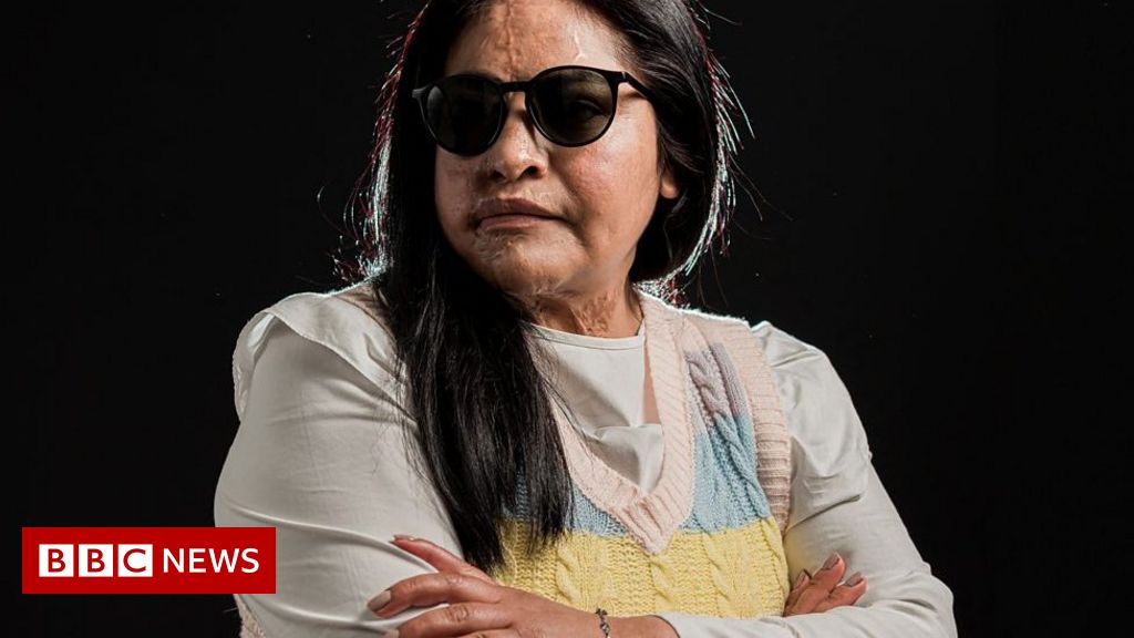 Sobrevivientes de ataque con ácido en México: ‘La justicia no es suficiente’