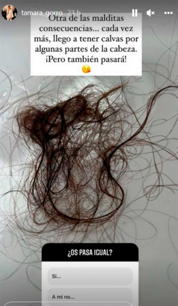 Tamara Gorro muestra las secuelas de su enfermedad / Instagram @tamara_gorro