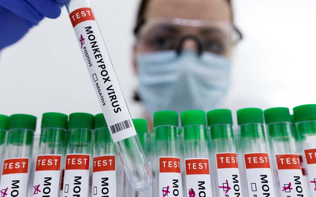 Viruela del mono en 23 países y 120 casos sospechosos: OMS