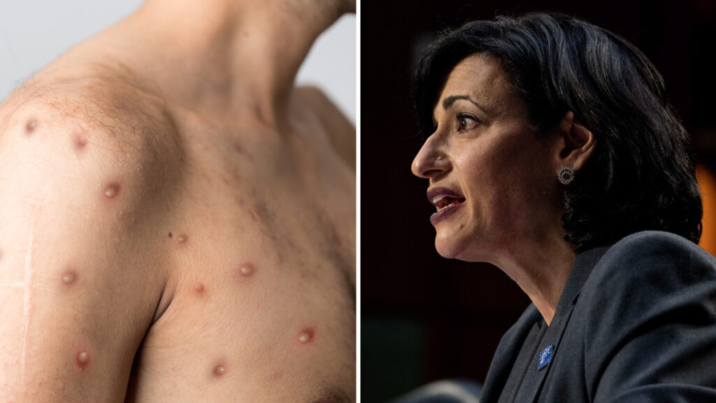 expertos creen que habría transmisión comunitaria en Estados Unidos