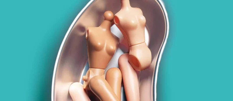 uglies-netflix-adaptación adaptacion fea de netflix