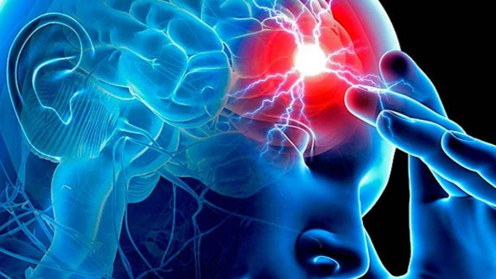 Cuáles son los primeros síntomas del ictus