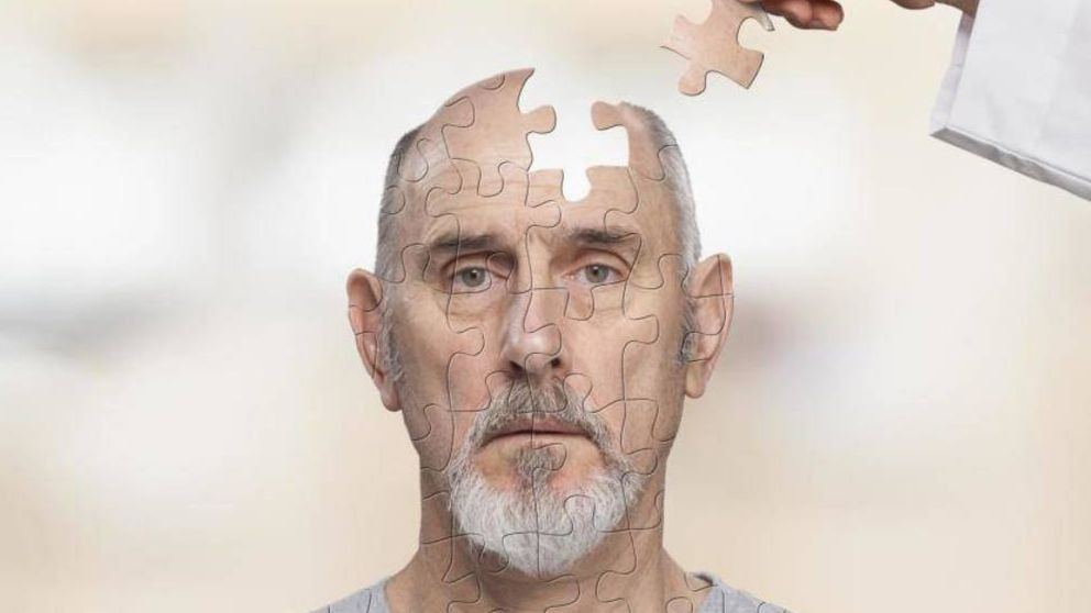 Curiosidades sobre el alzheimer qué querrás conocer
