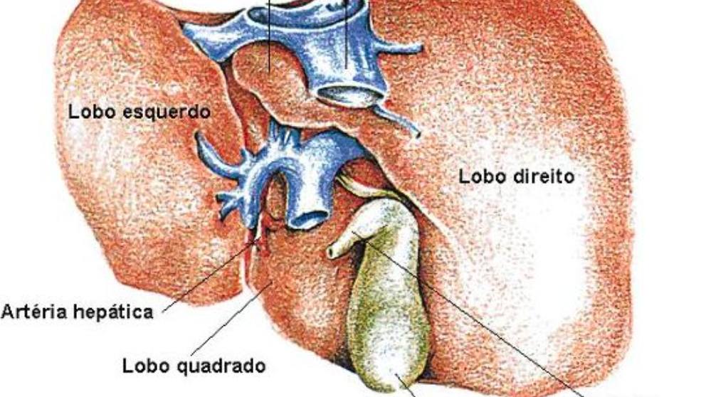 Descubre qué es un cálculo biliar y cómo se produce