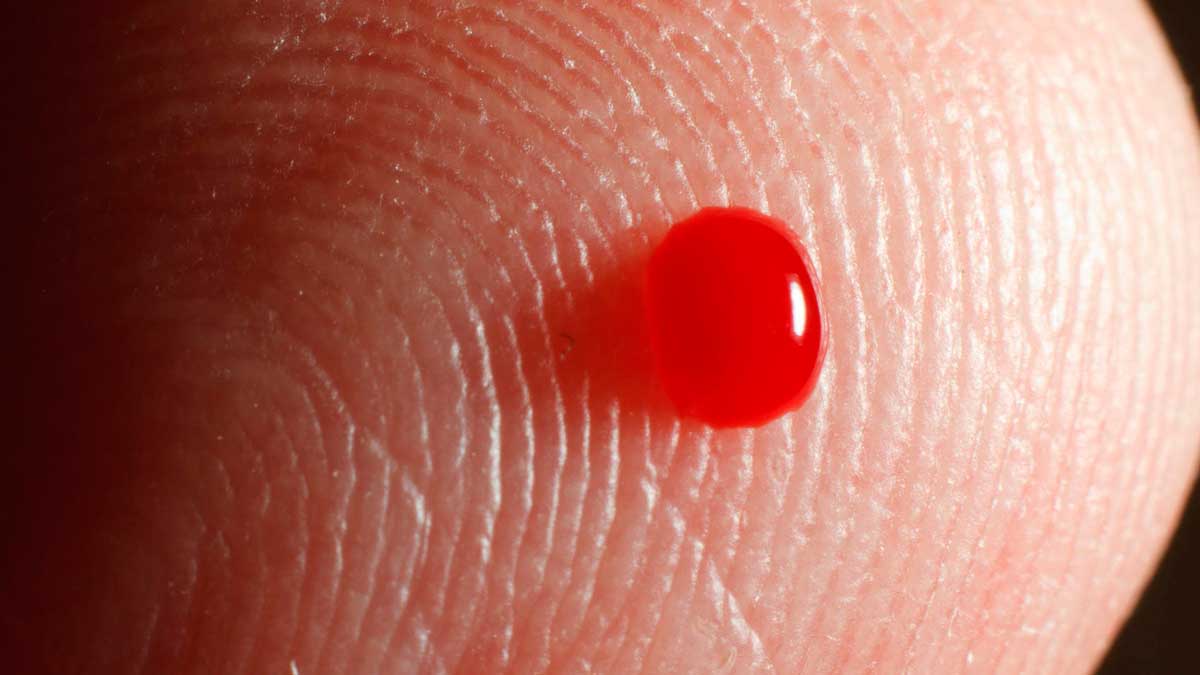 Extravasación: definición y tipos