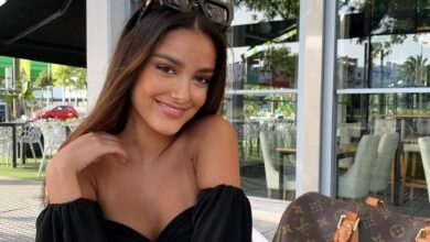 Julia Janeiro se somete a un nuevo tratamiento estético y lo enseña en redes