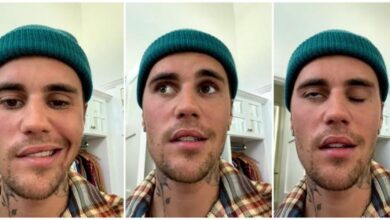 Justin Bieber muestra el "grave" virus que le provoca una parálisis parcial en el rostro