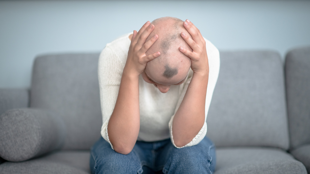 La FDA aprueba fármaco para la caída del cabello causada por la alopecia