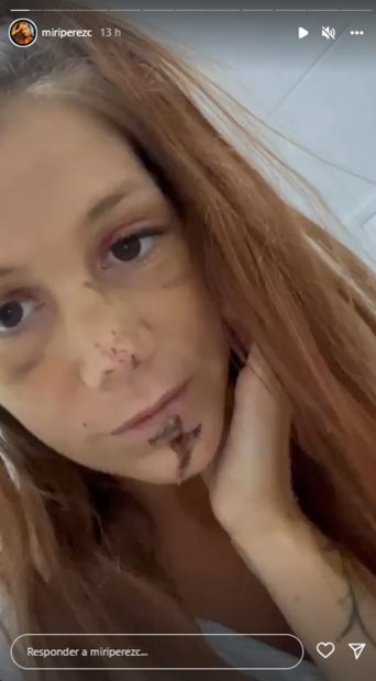Storie de Miri / Instagram