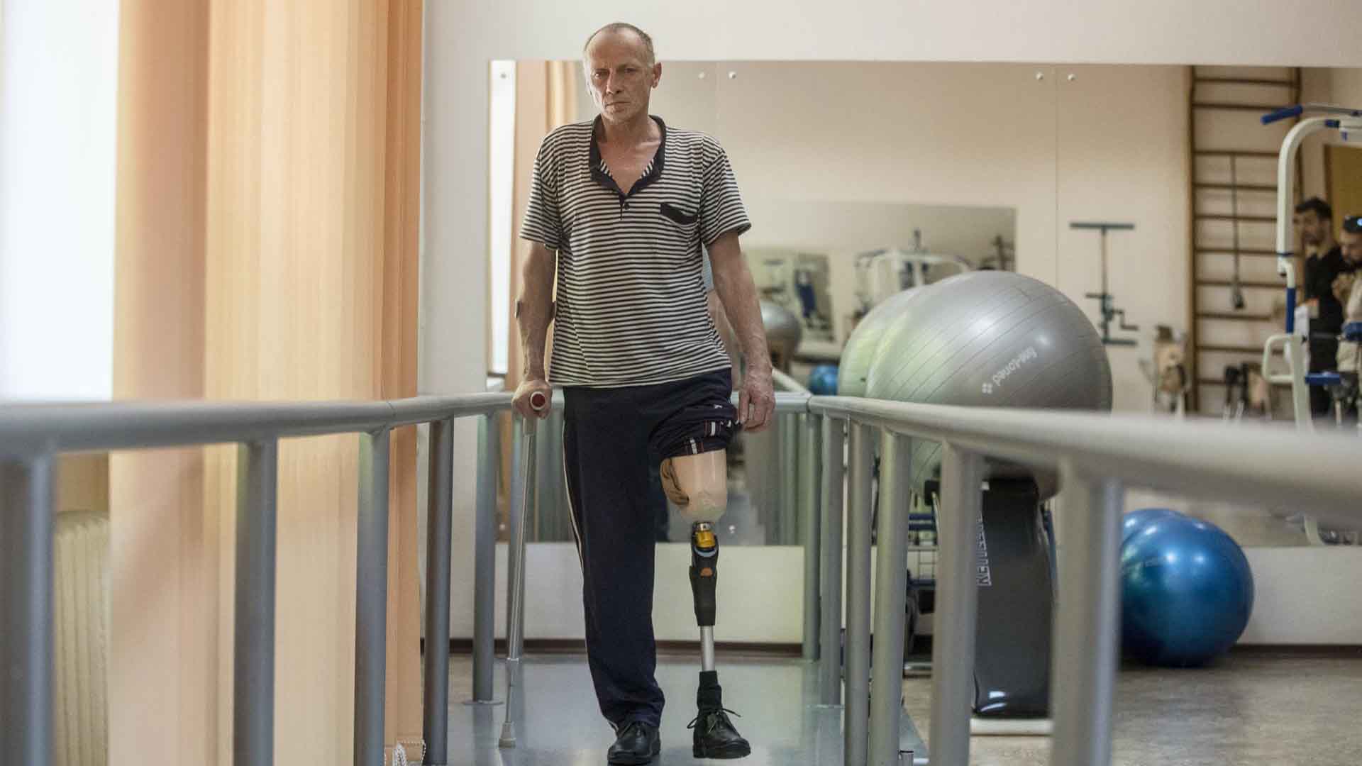 No solo armas, Ucrania también necesita prótesis para mutilados “en estos tiempos difíciles”