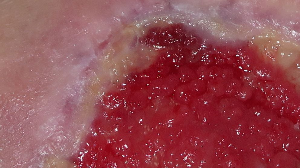 Qué es el tejido granular y cuál es su estructura