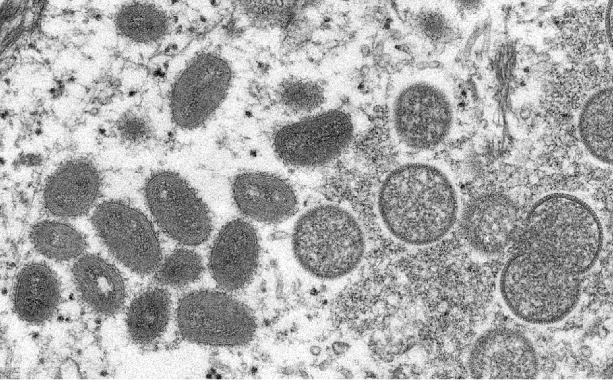 Son cada vez más frecuentes los brotes de enfermedades endémicas como la viruela del mono: OMS