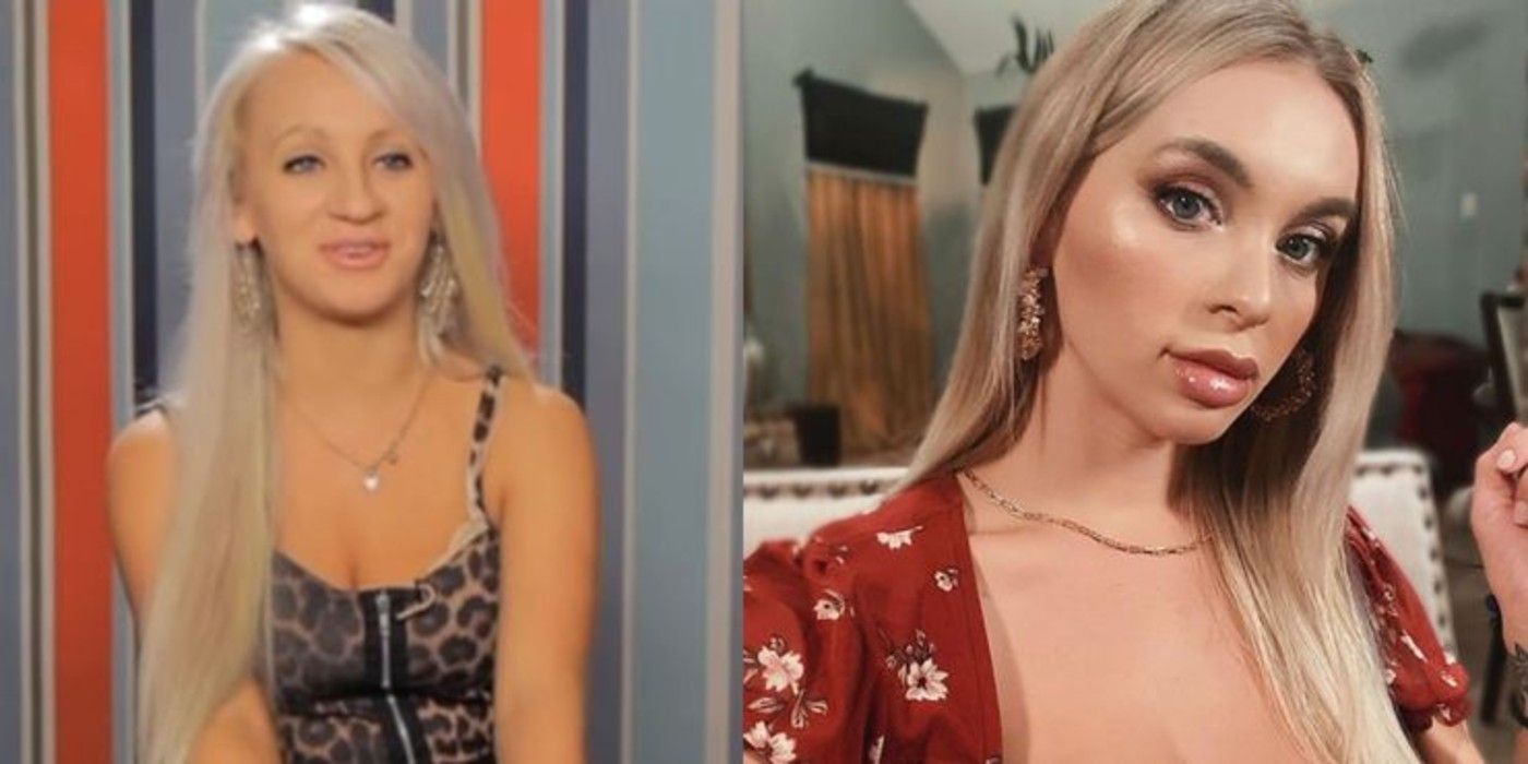 Todo en 90 días: miembros del elenco que se sometieron a una cirugía de rinoplastia