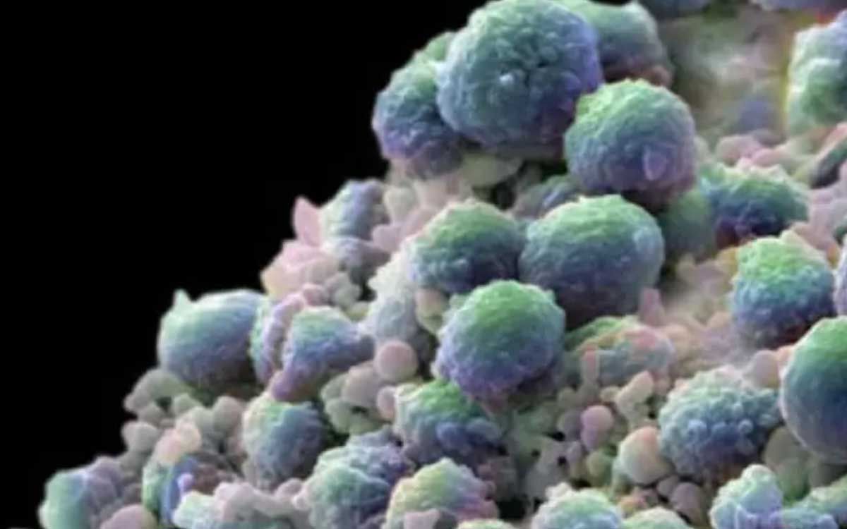 Uno de cada seis mexicanos, con riesgo de padecer cáncer de próstata: Incan