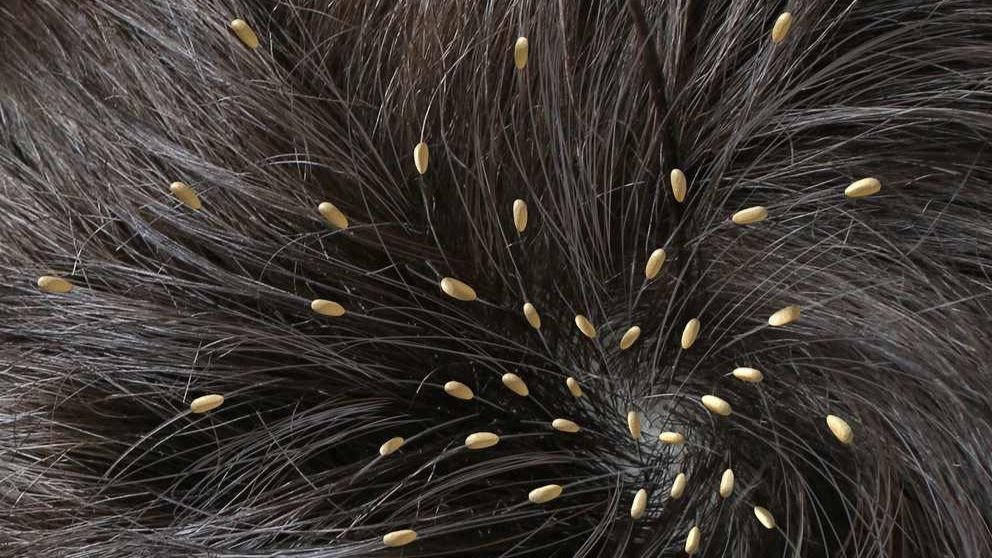 ¿Cómo son las liendres?