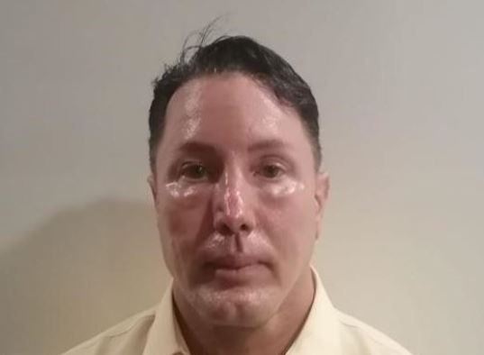 sospechoso de matar a su novia en México se habría operado la cara