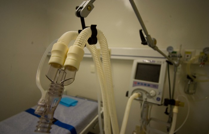 CNDH emite recomendación a favor de joven a quien amputaron piernas por negligencia en IMSS