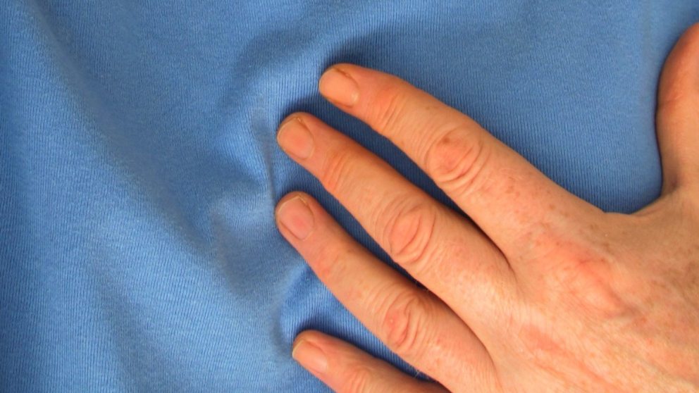 Cómo funciona un marcapasos