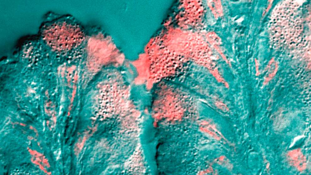 Descubre qué significa cada color de los mocos