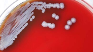 Detectan en EU bacteria que causa la rara y grave enfermedad melioidosis
