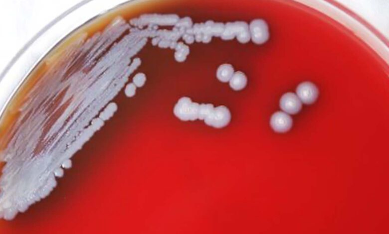 Detectan en EU bacteria que causa la rara y grave enfermedad melioidosis