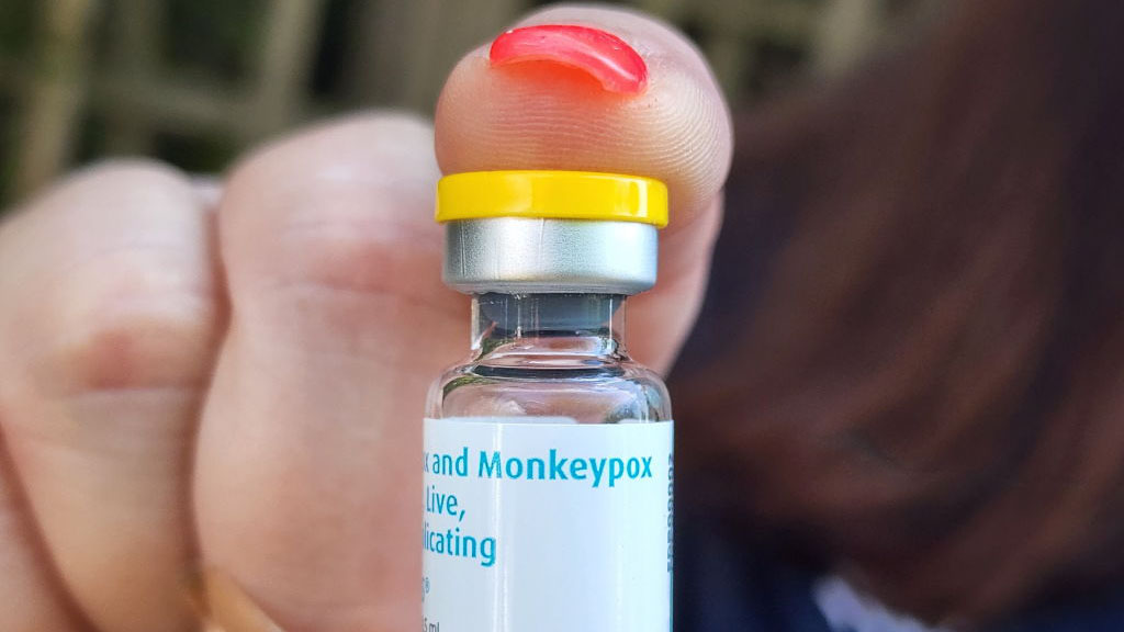 EEUU planea distribuir 800,000 dosis de vacunas contra la viruela del mono